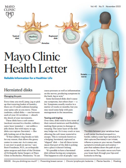 Mayo Clinic Q and A: Herniation can happen to a disk for a number of  reasons - Mayo Clinic News Network
